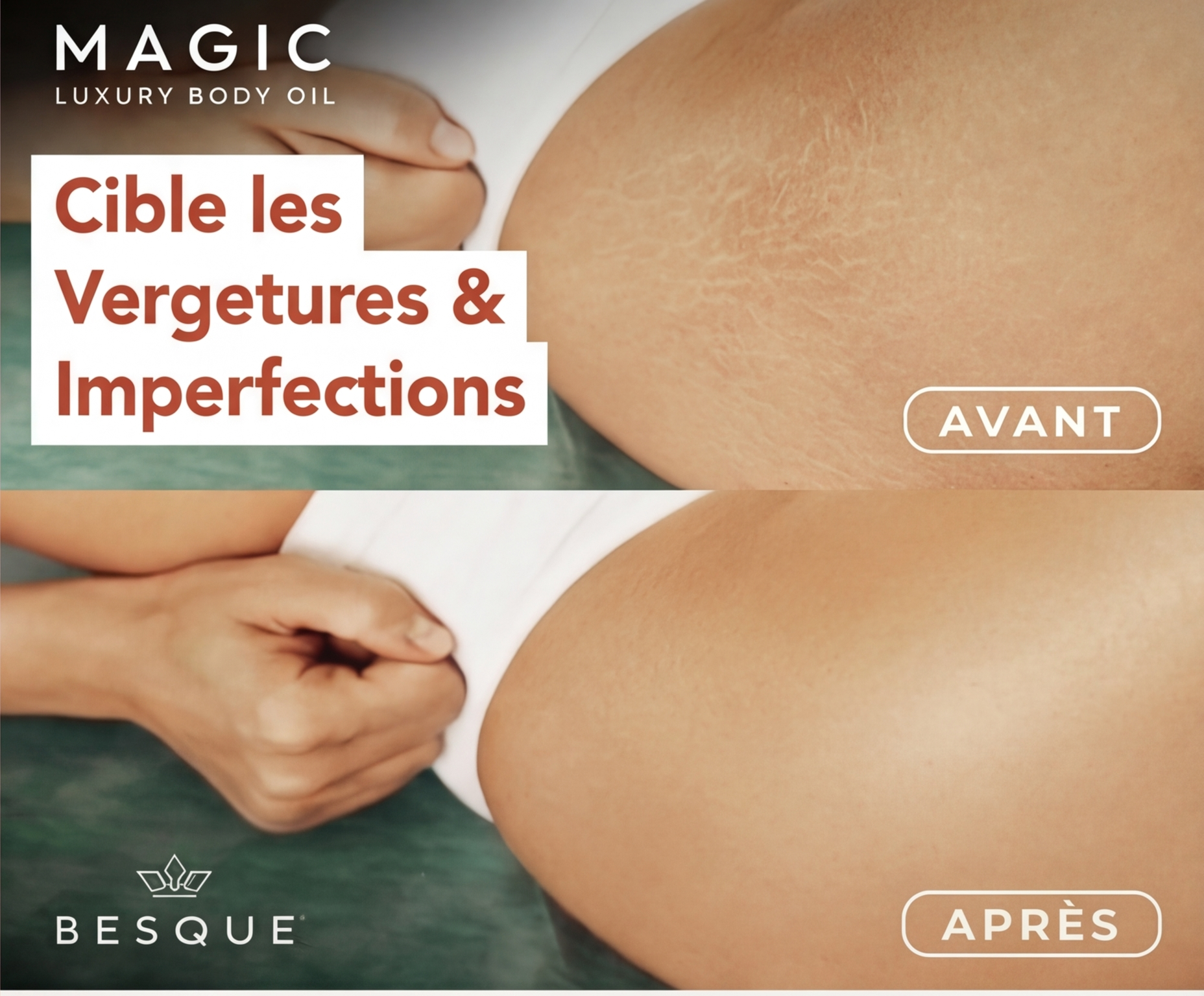Huile corporelle Besque® Magic XL - 200 ml